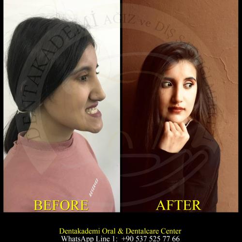 صور قبل وبعد لمرضانا 11